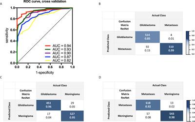 Deep Neural Network for Differentiation of Brain Tumor Tissue Displayed by Confocal Laser Endomicroscopy